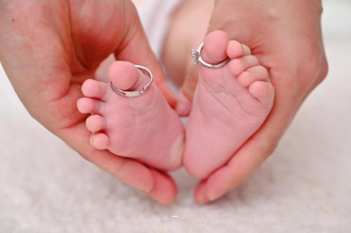 朝阳孕妇怎样预防妊娠纹